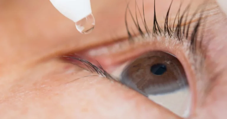 Safely Removing an Eyelash in the Eye: Tips and Precautions