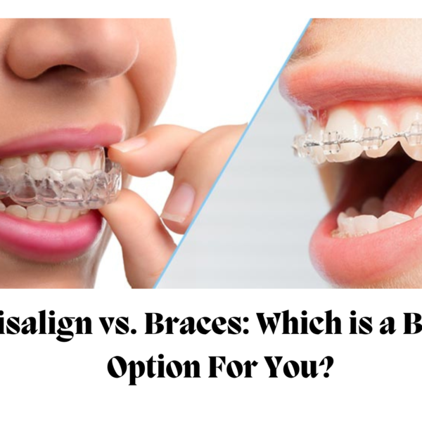 Invisalign vs. Braces: Which is a Better Option For You