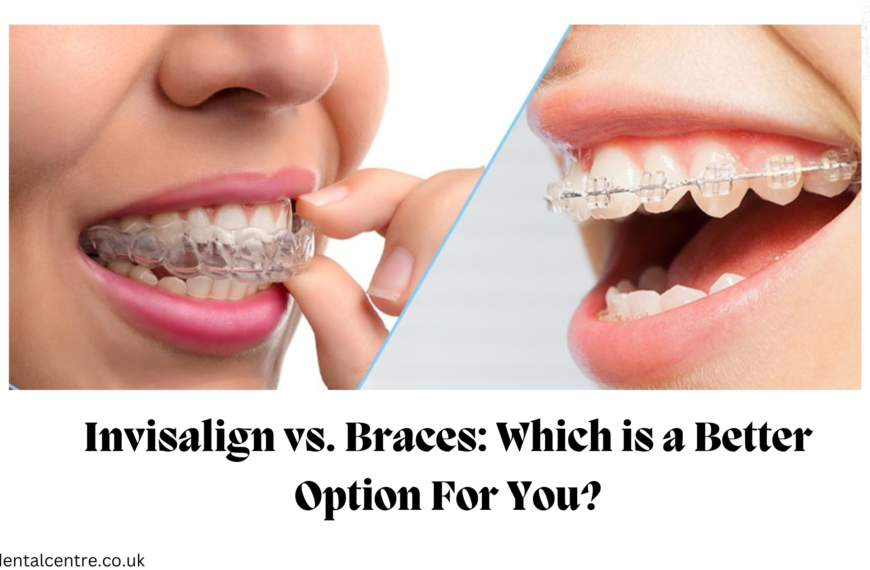 Invisalign vs. Braces: Which is a Better Option For You